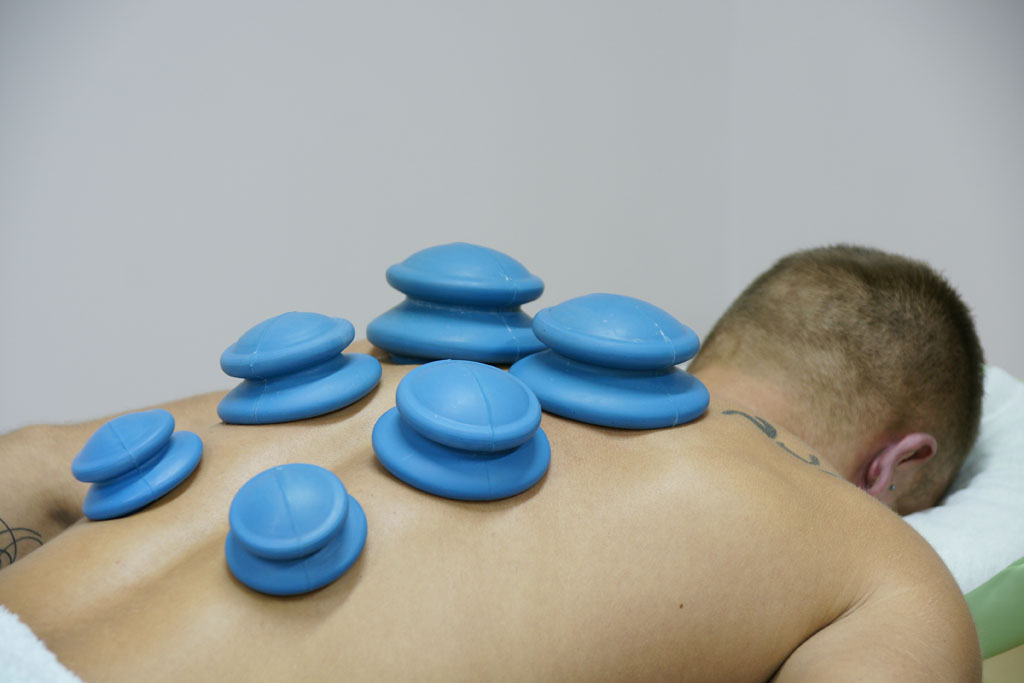 mężczyzna leży na brzuchu z bańkami na plecach podczas masażu